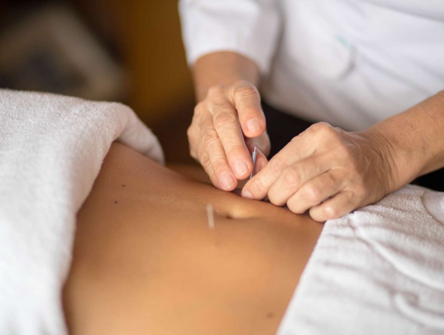Acupuntura